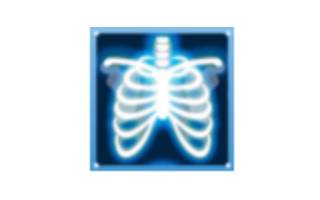Brustkorb-Röntgenbild